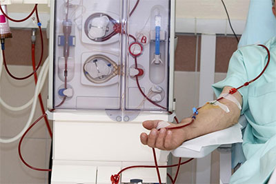 Hemo-dialysis-services